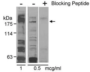 WB analysis of HeLa cells with (+) or without (-) blocking peptide using GTX23719 Claspin antibody. Dilution : 1 or 0.5 microg/ml