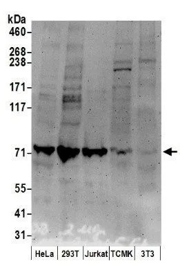 WB analysis of HeLa, 293T, Jurkat, TCMK-1, and NIH3T3 cell lysates using GTX23732 MCM7 antibody. Loading : 50microg Dilution : 2 microg/ml