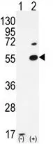 WB analysis of 293 cell lysate (2 ug/lane) either nontransfected (Lane 1) or transiently transfected with the PRMT2 (Lane 2) using GTX23763 PRMT2 antibody.
