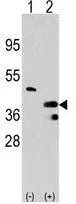 WB analysis of 293 cell lysate (2 ug/lane) either nontransfected (Lane 1) or transiently transfected with the PRMT1 (Lane 2) using GTX23768 PRMT1 antibody.