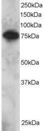 WB analysis of Daudi lysate using GTX23823 SETMAR antibody. Dilution : 2microg/ml Loading : 30microg protein in RIPA buffer