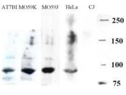 Western blotting. GeneTexs Goat-anti-Artemis was used at a 1:500 dilution to detect Artemis is various cell lysates by Western blot. CJ is an Artemis deficient cell line and so no band is visible.