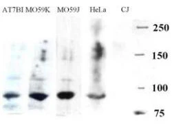 WB analysis of various samples using GTX23834 Artemis antibody. Lane 1 : AT7BI whole cell lysate Lane 2 : M059K whole cell lysate Lane 3 : M059J whole cell lysate Lane 4 : HeLa whole cell lysate Lane 5 : CJ whole cell lysate Dilution: 1:500