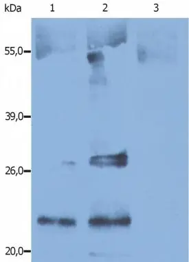 Immunoprecipitation of human CD9 from the biotin-labeled human platelets lysates. Lane 1: immunoprecipitation with anti-CD9 (GTX23923) Lane 2: immunoprecipitation with anti-human CD9 control antibody Lane 3: immunoprecipitation with negative control