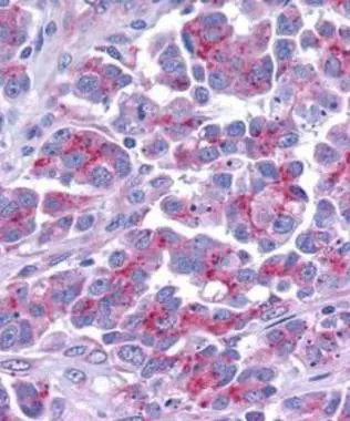 Immunohistochemical staining of Smac in human ovary with Diablo antibody at 5microg /ml.