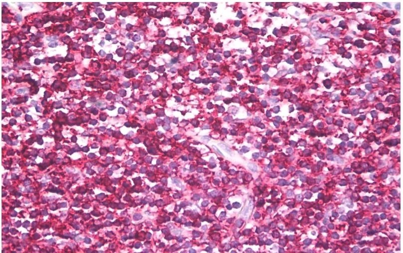 IHC-P analysis of human tonsil tissue using GTX23979 CD45RB antibody [MEM-143].