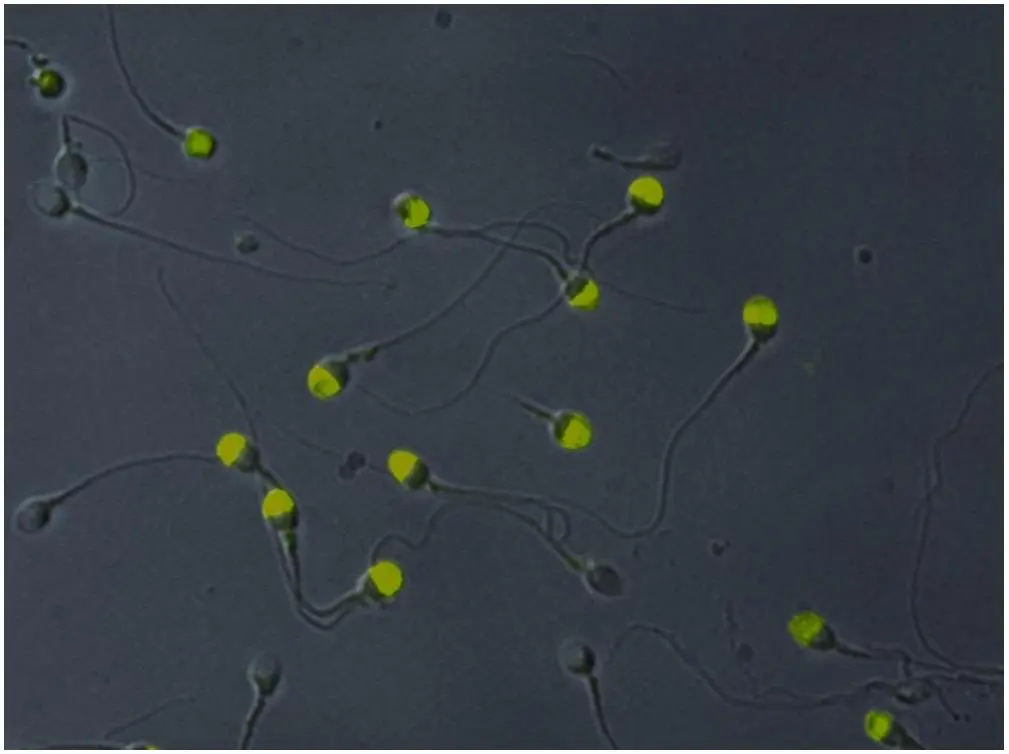 ICC/IF analysis of acetone-permeabilized human sperms (normal spermiogram) using GTX23983 VCP antibody [Hs-14].