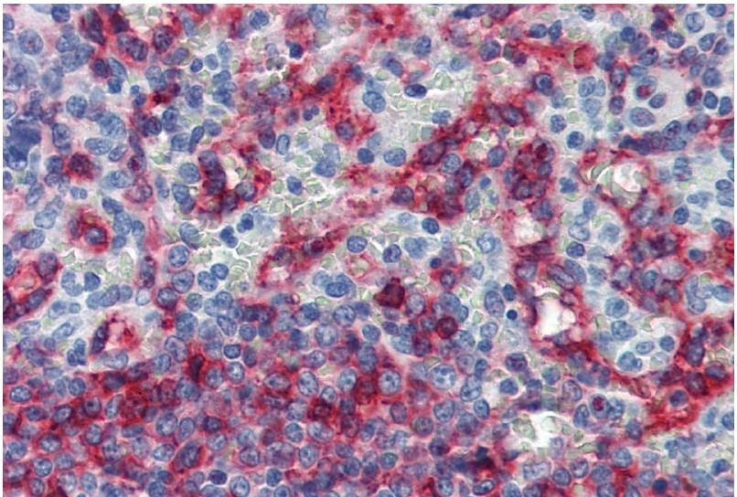 IHC-P analysis of human spleen tissue using GTX23984 HLA-E antibody [MEM-E/06].
