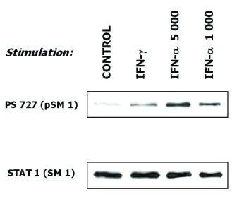 Western blot,GTX23987 STAT1 antibody [SM1]. Induction of phosphorylation of STAT 1 at Ser727 in human malignant melanoma cells (short-term culture derived from a patient) in response to interferons. Subconfluent cells were serum-starved before exposure