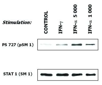 WB analysis of human malignant melanoma cells (short-term culture derived from a patient) treated with IFN-gamma (10 ng/ml) and IFN-alpha (1000 IU/ml and 5000 IU/ml) using GTX23987 STAT1 antibody [SM1]. Upper Lane : GTX23991 STAT1 (phospho Ser727) antibody [PSM1] Lower Lane : GTX23987 STAT1 antibody [SM1]
