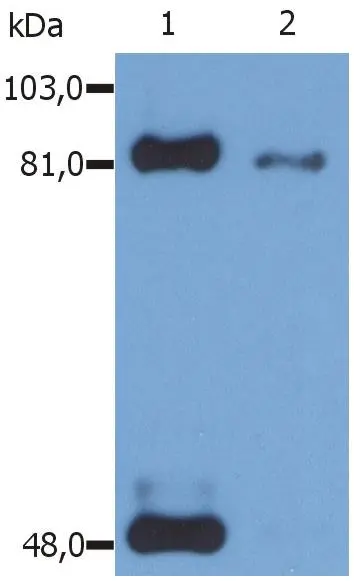 Western Blot analysis (reducing conditions) of phosphorylated STAT1 (Ser727) in IFN-? treated HeLa human cervix carcinoma cell line using anti-Phospho STAT1 (GTX23991).