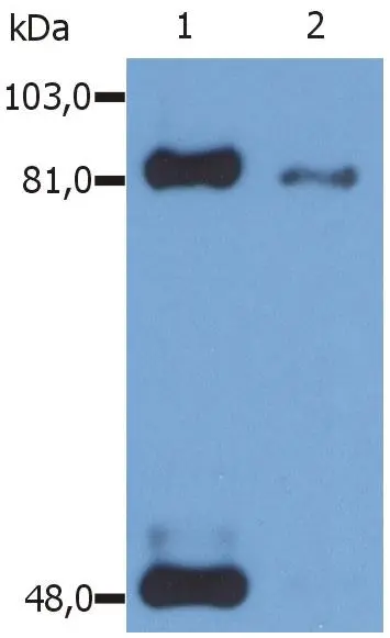 WB analysis of IFN-gamma treated HeLa cell lysate using GTX23991 STAT1 (phospho Ser727) antibody [PSM1]. Lane 1 : Immunoprecipitate by another anti-STAT1 antibody Lane 2 : Original whole cell lysate