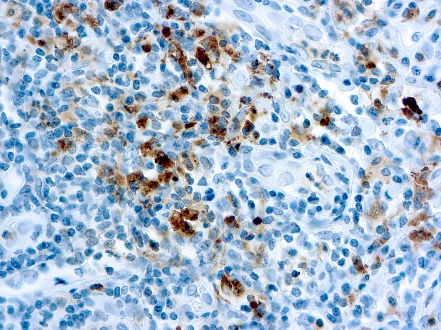 IHC-P analysis of human tonsil tissue using GTX24059 Granzyme B antibody.