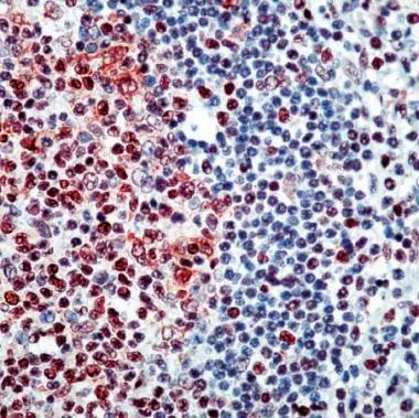 IHC Image using GTX24071 - Detection of E2F4 by IHC in Human Tonsil