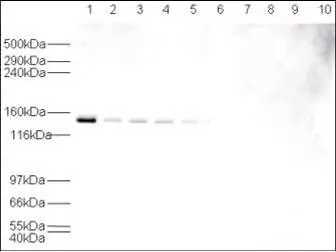 WB analysis of various samples using GTX24080 USP7 antibody prior incubated with (Lane 6-10) or without (Lane 1-5) blocking peptide.<be>Lane 1 and 6 : HeLa nuclear extracts Lane 2 and 7 : HeLa whole cell lysates Lane 3 and 8 : A431 whole cell lysates Lane 4 and 9 : MCF-7 whole cell lysates Lane 5 and 10 : NIH-3T3 whole cell lysates Dilution : 1:500