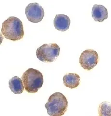 ICC/IF analysis of HeLa cells using GTX24106 DR5 antibody.