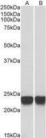 WB analysis of HeLa (A) and Jurkat (B) lysates using GTX24150 Park7 / DJ-1 antibody. Dilution : 0.001microg/ml Loading : 35microg protein in RIPA buffer