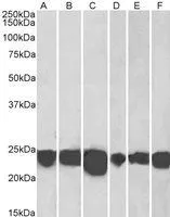 WB analysis of human cerebellum (A), human frontal cortex (B), human hippocampus (C) mouse Fetal brain (D), mouse brain (E) and rat brain (F) lysates using GTX24150 Park7 / DJ-1 antibody. Dilution : 0.001microg/ml Loading : 35microg protein in RIPA buffer