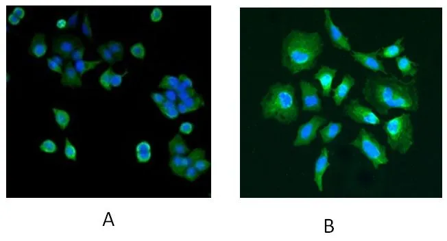 ICC/IF analysis of MCF7 (A) and HeLa (B) cells using GTX24150 Park7 / DJ-1 antibody. Dilution : 5microg/ml