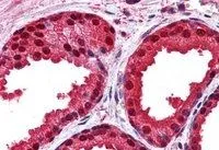 IHC-P analysis of human prostate using GTX24150 Park7 / DJ-1 antibody. Antigen retrieval : citrate buffer pH 6 Dilution : 3.75microg/ml