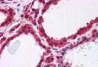 IHC-P analysis of human thyroid using GTX24150 Park7 / DJ-1 antibody. Antigen retrieval : citrate buffer pH 6 Dilution : 3.75microg/ml