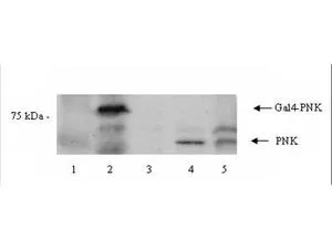 Western blot using GeneTexs Affinity Purified anti-PNK antibody shows detection of a 57 kDa band corresponding to human PNK in a Y190 yeast cell lysate (lane 1), Y190 yeast cell lysate + human PNK (Gal DNA BP) (lane 2), EM9 XH Chinese hamster ovary cell lysate (lane 3), EM9 XH Chinese hamster ovary cell lysate + human PNK (lane 4) and a HeLa cell lysate (lane 5).? Approximately 10 microg of lysate was run on SDS-PAGE and transferred onto nitrocellulose followed by reaction with a 1:1000 dilution of anti-PNK antibody incubated for 1 hr in TBST at room temperature.? Signal was detected using standard techniques.