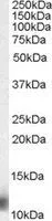 WB analysis of Jurkat lysate using GTX24385 MPS1 antibody. Dilution : 0.03microg/ml Loading : 35microg protein in RIPA buffer