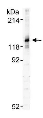 WB analysis of HeLa nuclear extract using GTX24455 SA1 antibody. Dilution : 0.5 microg/ml