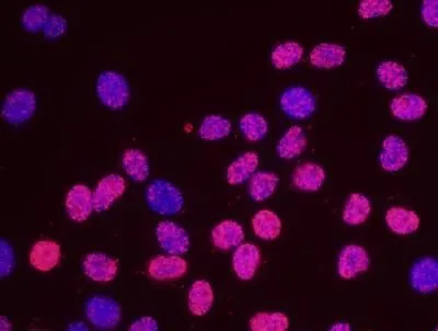 PLA analysis of HeLa cells using GTX24461 MCM2 antibody and anti-human MCM6 antibody. Red : positive signal Blue : DAPI