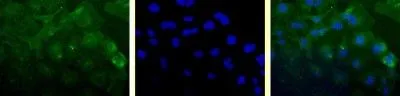 ICC/IF analysis of HeLa cells using GTX24470 Survivin antibody [60.11]. Green : primary antibody Blue : Hoechst 33258