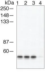 WB analysis of PC12 cell extracts were either not treated (Lane 1, 3) or treated (Lane 2, 4) with PP2A phosphatase using GTX24472 beta Arrestin 1 (phospho Ser412) antibody(Lane 3, 4) or b-arrestin-1 pan antibody(Lane 1, 2).