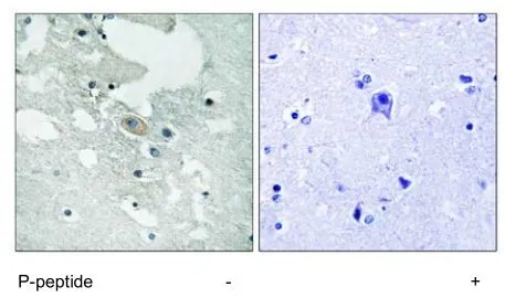 IHC-P analysis of human brain tissue using GTX24474 BLNK (phospho Tyr84) antibody.
