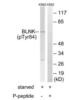 WB analysis of K562 cell lysate using GTX24474 BLNK (phospho Tyr84) antibody.