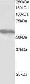 WB analysis of HepG2 lysate using GTX24527 TRIM4 antibody. Dilution : 1microg/ml Loading : 30microg protein in RIPA buffer