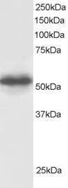 WB analysis of human testis lysate using GTX24535 CSN1 antibody,C-term. Dilution : 0.5ug/ml Loading : 30ug protein in RIPA buffer