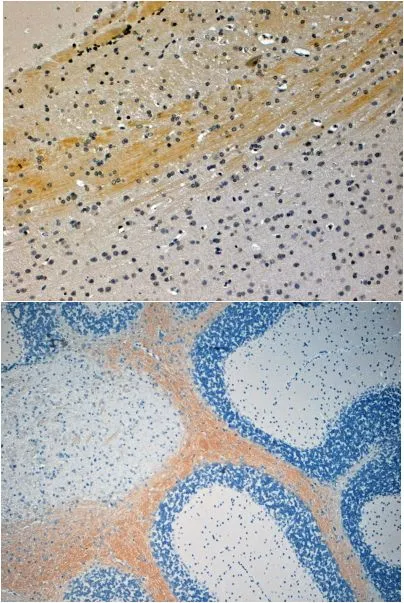 IHC-P analysis of mouse brain using GTX24545 JIP3 antibody, N-term. Antigen retrieval : citrate buffer pH 6 Dilution : 4microg/ml IHC-P analysis of mouse brain using GTX24545 JIP3 antibody, N-term. Antigen retrieval : citrate buffer pH 6 Dilution : 4microg/ml