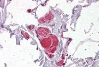 IHC-P analysis of human colon using GTX24549 VAV2 antibody, Internal. Antigen retrieval : citrate buffer pH 6 Dilution : 2.5microg/ml