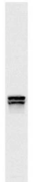 Western blots of whole yeast protein extracts with a collection of our antibodies. The blot for GTX24574 is in the indicated lane,and the number indicates the SDS-PAGE molecular weight in kDa