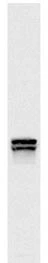Western blots of whole yeast protein extracts with a collection of our antibodies. The blot for GTX24574 is in the indicated lane, and the number indicates the SDS-PAGE molecular weight in kDa Western blots of whole yeast protein extracts with a collection of our antibodies. The blot for GTX24574 is in the indicated lane, and the number indicates the SDS-PAGE molecular weight in kDa