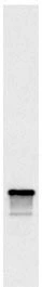 Western blots of whole yeast protein extracts with a collection of our antibodies. The blot for GTX24575 is in the indicated lane, and the number indicates the SDS-PAGE molecular weight in kDa. Western blots of whole yeast protein extracts with a collection of our antibodies. The blot for GTX24575 is in the indicated lane, and the number indicates the SDS-PAGE molecular weight in kDa.