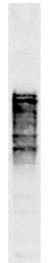 Western blots of whole yeast protein extracts with a collection of our antibodies. The blot for GTX24641 is in the indicated lane,and the number indicates the SDS-PAGE molecular weight in kDa.