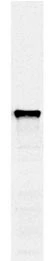 Western blots of whole yeast protein extracts with a collection of our antibodies. The blot for GTX24644 is in the indicated lane,and the number indicates the SDS-PAGE molecular weight in kDa.