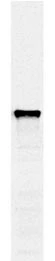 Western blots of whole yeast protein extracts with a collection of our antibodies. The blot for GTX24644 is in the indicated lane, and the number indicates the SDS-PAGE molecular weight in kDa.