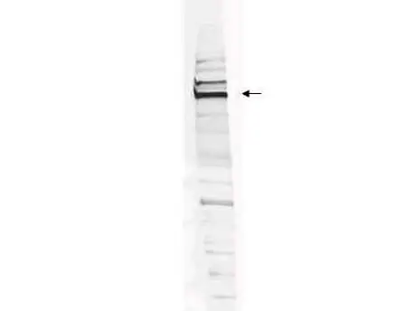 WB analysis of 293T whole cell lysate using GTX24731 WHIP antibody. Loading : 30 microg Dilution : 1:200