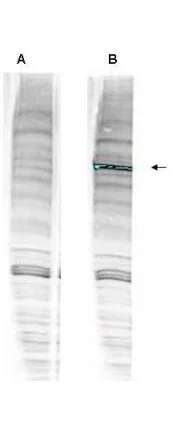 WB analysis of 293T whole cell lysate using GTX24731 WHIP antibody prior incubated with (Lane B) or without (Lane A) blocking peptide. Loading : 30 microg Dilution : 1:1000