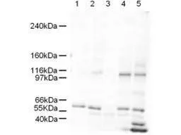 Western blot using GeneTexs Affinity Purified anti-SmarcAL1 antibody shows detection of a band ~106 kDa band corresponding to SmarcAL1 in human derived cultured cell lysates (Lane1: HeLa nuclear extract, Lane2: HeLa cells, Lane3: A431 celss, lane 4: Jurkat cells, Lane5: 293T cells). Approximately 5microg of each lysates was run on a SDS-PAGE and transferred onto nitrocellulose followed by reaction with a 1:500 dilution of anti-SmarcAL1 antibody. Signal was detected using standard techniques. SmarcAL1 is the band seen between the 97 and 116kD markers.