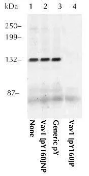 IP analysis of K562 cell extracts using GTX24763 VAV1 (phospho Tyr160) antibody. The primary antibody was prior incubate with no peptide (1), the non-phosphopeptide corresponding to the immunogen (2), a generic phosphotyrosine containing peptide (3), or, the phosphopeptide immunogen (4) WB antibody dilution : 0.5 microg/ml IP analysis of K562 cell extracts using GTX24763 VAV1 (phospho Tyr160) antibody. The primary antibody was prior incubate with no peptide (1), the non-phosphopeptide corresponding to the immunogen (2), a generic phosphotyrosine containing peptide (3), or, the phosphopeptide immunogen (4) WB antibody dilution : 0.5 microg/ml