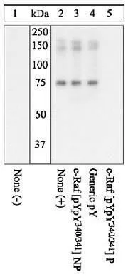 WB (peptide competition) analysis of HEK293 cells overexpressing c-Raf unstimulated (Lane 1) or stimulated with active Src (Lane 2-5) using GTX24769 Raf1 (phospho Tyr340/Tyr341) antibody prior incubated with non-phosphopeptide corresponding to the phosphopeptide immunogen (Lane 3), a generic phosphotyrosine-containing peptide (Lane 4), or the phosphopeptide immunogen (Lane 5). The data show that only the immunogen phosphopeptide blocks the signal, demonstrating the specificity of the antibody. WB (peptide competition) analysis of HEK293 cells overexpressing c-Raf unstimulated (Lane 1) or stimulated with active Src (Lane 2-5) using GTX24769 Raf1 (phospho Tyr340/Tyr341) antibody prior incubated with non-phosphopeptide corresponding to the phosphopeptide immunogen (Lane 3), a generic phosphotyrosine-containing peptide (Lane 4), or the phosphopeptide immunogen (Lane 5). The data show that only the immunogen phosphopeptide blocks the signal, demonstrating the specificity of the antibody.