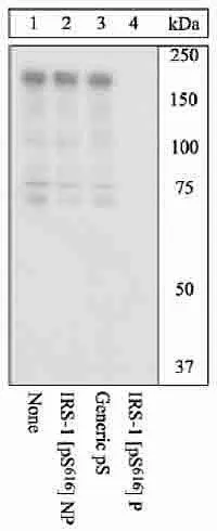WB analysis of 293T cells transfected with wild-type human IRS-1 and treated with 100ng/mL TPA for 30 minutes using GTX24776 IRS1 (phospho Ser616) antibody prior incubated with the non-phosphopeptide corresponding to the phosphopeptide immunogen (Lane 2), a generic phosphoserine-containing peptide (Lane 3), or the phosphopeptide immunogen (Lane 4).