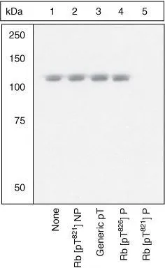WB analysis of samples using GTX24787 Rb (phospho Thr821) antibody prior incubated with the non-phosphopeptide corresponding to the phosphopeptide immunogen (Lane 2), a generic phosphothreonine containing peptide(Lane 3), the phosphopeptide corresponding to Rb (phospho Thr826), or the phosphopeptide immunogen (Lane 5). The data show that only the immunogen phosphopeptide blocks the signal, demonstrating the specificity of the antibody. WB analysis of samples using GTX24787 Rb (phospho Thr821) antibody prior incubated with the non-phosphopeptide corresponding to the phosphopeptide immunogen (Lane 2), a generic phosphothreonine containing peptide(Lane 3), the phosphopeptide corresponding to Rb (phospho Thr826), or the phosphopeptide immunogen (Lane 5). The data show that only the immunogen phosphopeptide blocks the signal, demonstrating the specificity of the antibody.